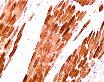 Myoglobin