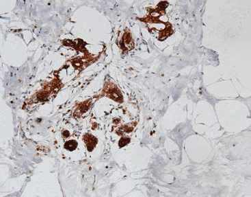 nm23 Protein
