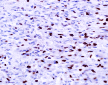Olig-2