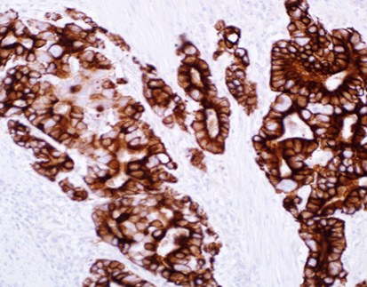 Mucin-4 Glycoprotein