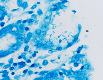 Helicobacter Pylori Staining Kit