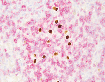 EBER/IHC Dual Staining Kit