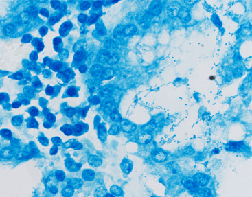 Helicobacter Pylori Staining Kit