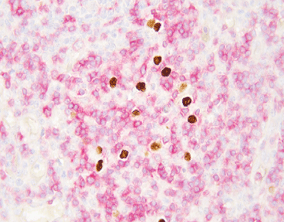 EBER/IHC Dual Staining Kit