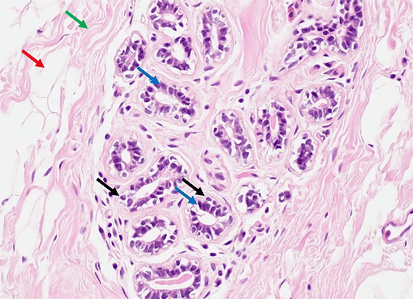 The Meaning of the IHC Markers