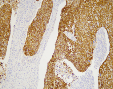 CK7,anti-mouse, monoclonal, OV-TL 12/30, C1C10