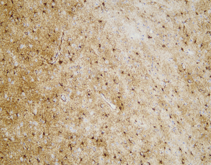 GFAP,anti-mouse,monoclonal,GA5