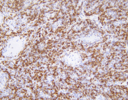 Bcl-2-anti mosue, monoclonal