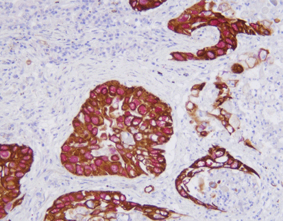 CK5/6/p40 detection reagent (Immunohistochemical)