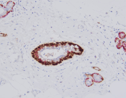 Calponin/p63 detection reagent (Immunohistochemical)