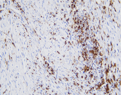CD68 (Macrophage)-anti mouse-monoclonal