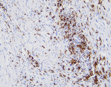CD68 (Macrophage)-anti mouse-monoclonal