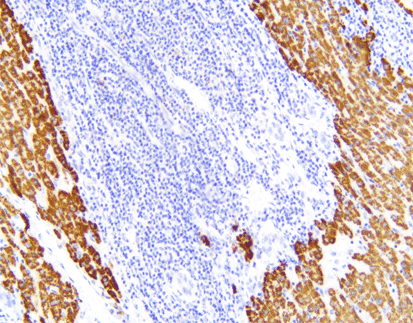 HSA Hepatocyte Specific Antigen