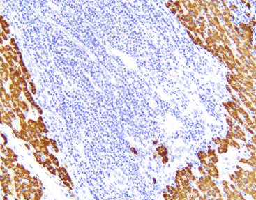 HSA Hepatocyte Specific Antigen