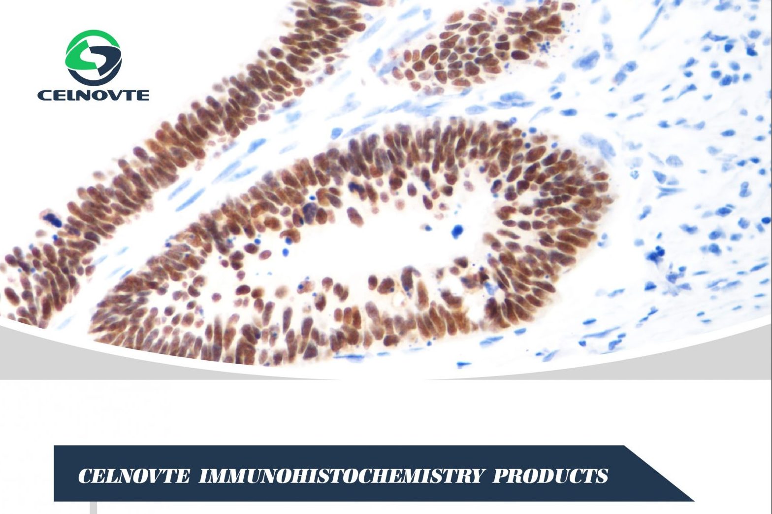 CELNOVTE IHC Secondary Antibody Help High-level Scientific Research!