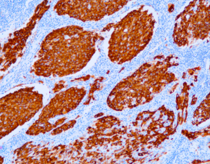 Melanoma Marker(CD63)