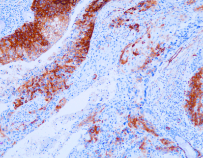 Myosin Heavy Chain (MHC)