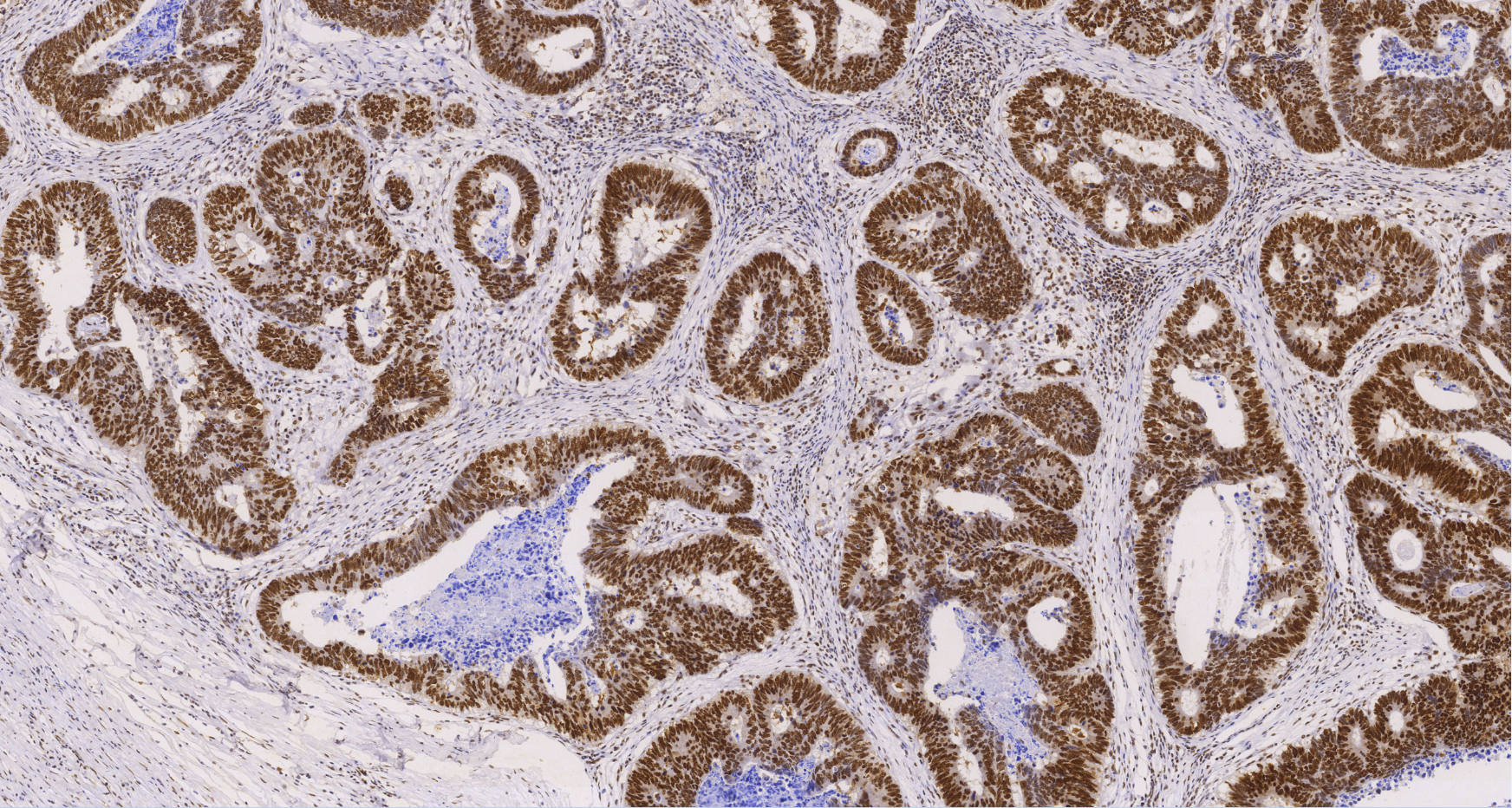 Mismatch Repair Protein(MLH1)-IHC primary antibody