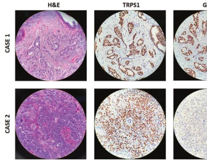 TRPS1 Immunohistochemistry primary antibody,anti-rabbit,monoclonal, EPR16171