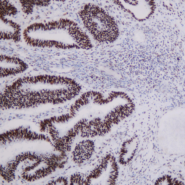 MMR panel | MSH2 (C2G3), MMab