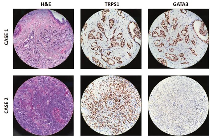 TRPS1 Immunohistochemistry primary antibody,anti-rabbit,monoclonal, EPR16171