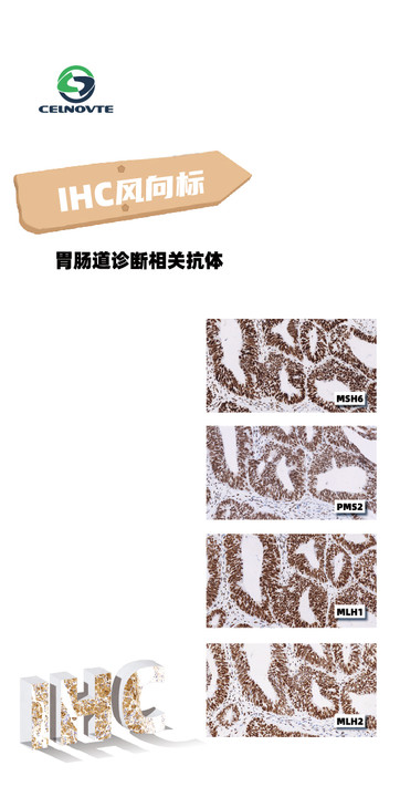Gastrointestinal Tumor diagnosis/IHC markers