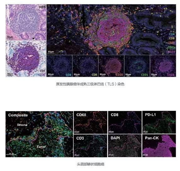 Multiplex immunohistochemical, mIHC kit