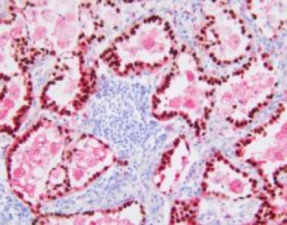 Multiplex immunohistochemical, mIHC kit