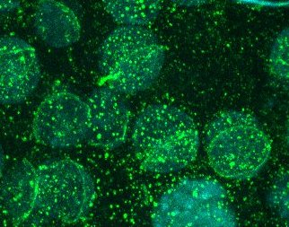 IMMUNOCYTOCHEMISTRY