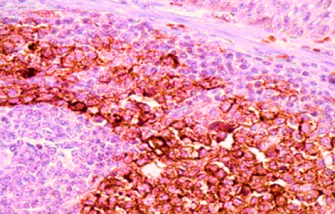 IMMUNOHISTOCHEMISTRY