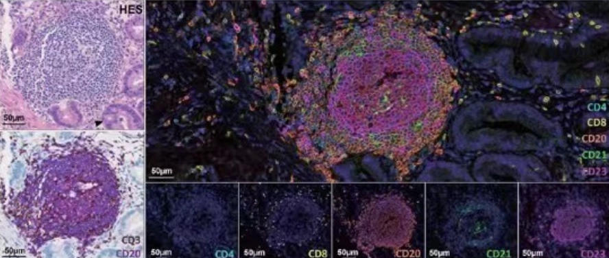 Advantages of mIHC Over Traditional IHC in Drug Development