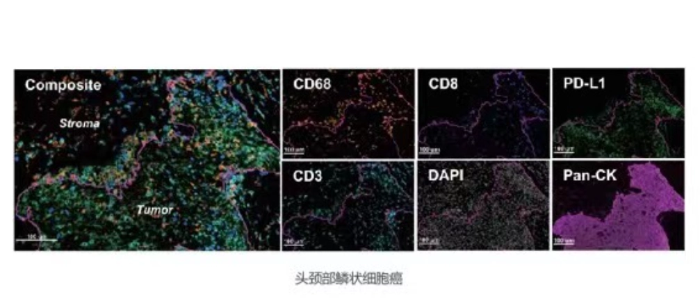 Multiplex Immunohistochemical (mIHC) Kits