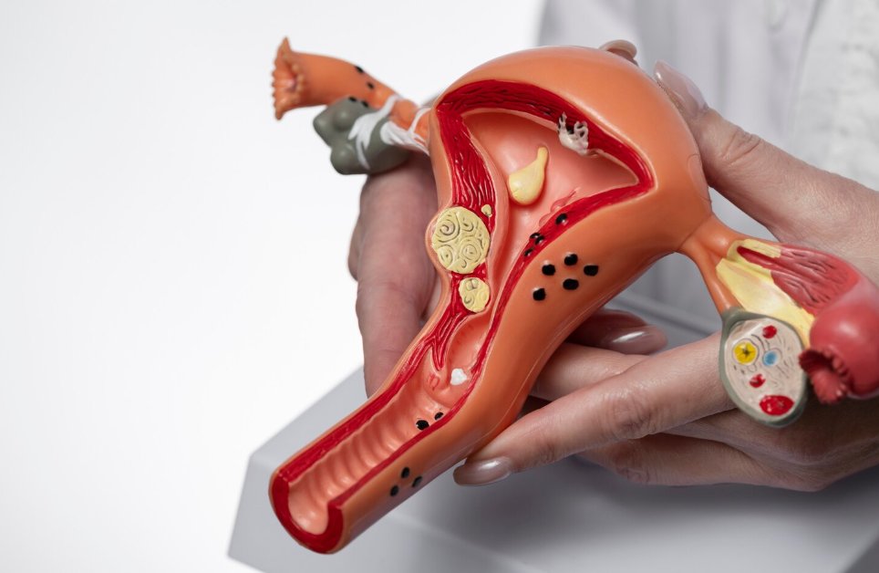 How p16 Helps Detect Early Cervical Changes