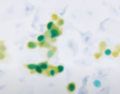 [Yellow/Cyan] P16/Ki-67 Dual Staining Detection Kit